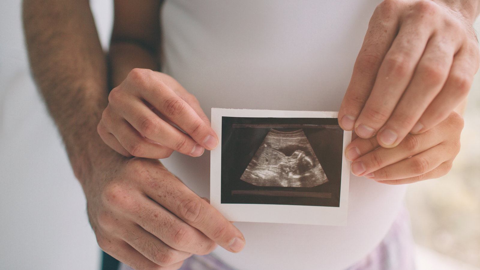 woman holding an ultrasound picture