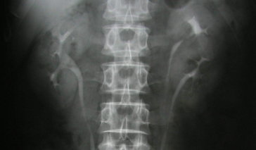 Contrast Radiology