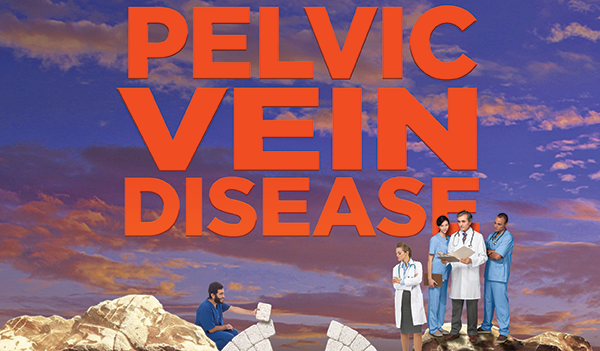 Doctors discussing pelvic vein disease
