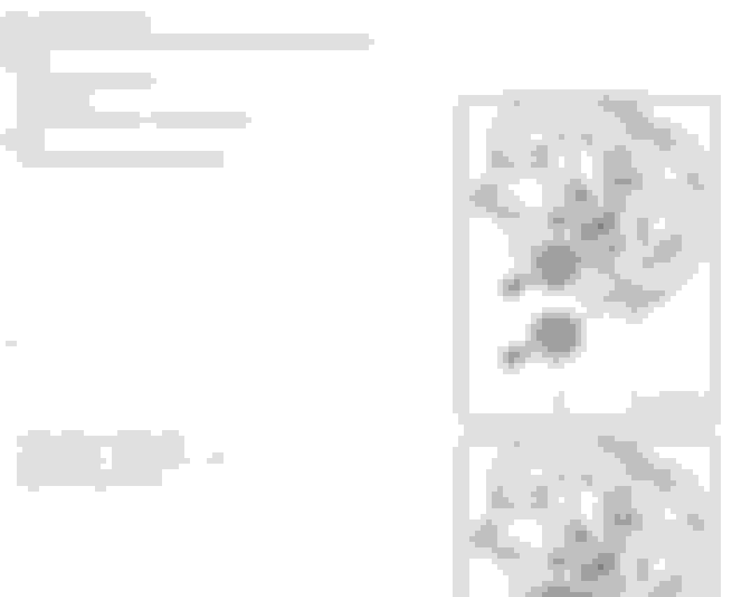 2013 Q5 2.0 Brake Caliper Torque AudiWorld Forums