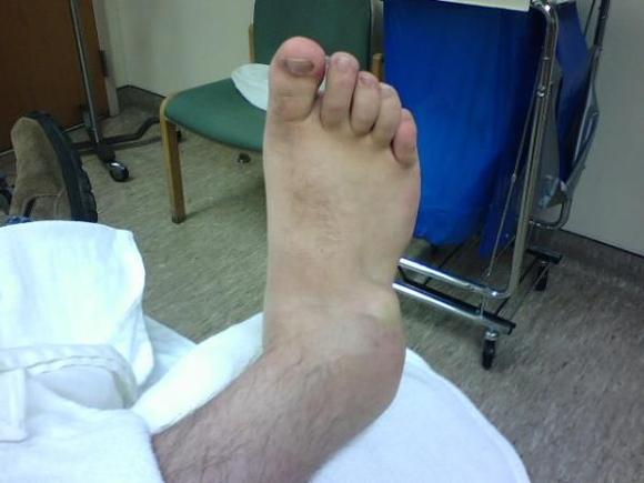 foot 1