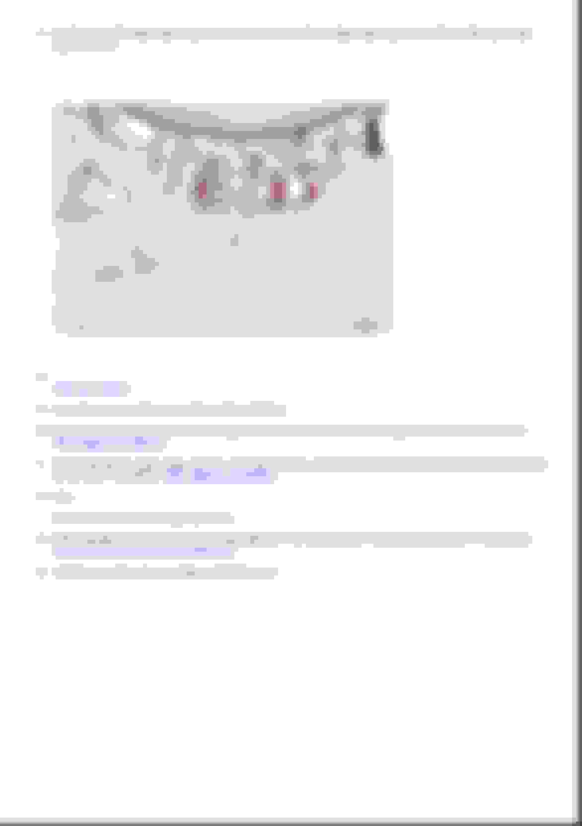 Rear caster question CorvetteForum Chevrolet Corvette Forum Discussion