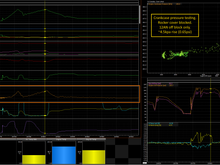 Block 1x AN12 line connected only. 1st/2nd gear pull. Approx 4.5kpa pressure rise (only 0.65psi). I wanted to check if the block only breather would be good enough for trackday use.