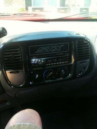 Carbon Fiber Radio Surround