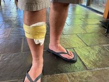 This would be a wad of tissues and masking tape 