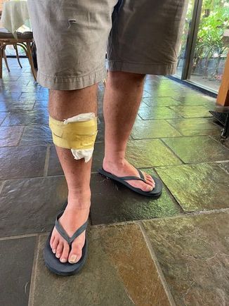 This would be a wad of tissues and masking tape 