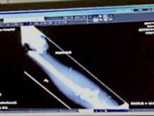 left wrist after repositioning for x-ray 92 minutes after accident.  the hand was hanging off my left elbow