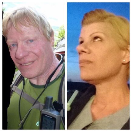 Before and after? Or after and before?