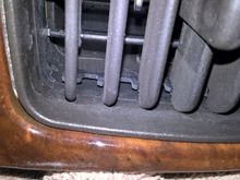 donor side vent used hemostat clamp to push off gently