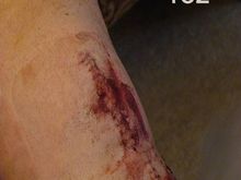 my leg152.jpg