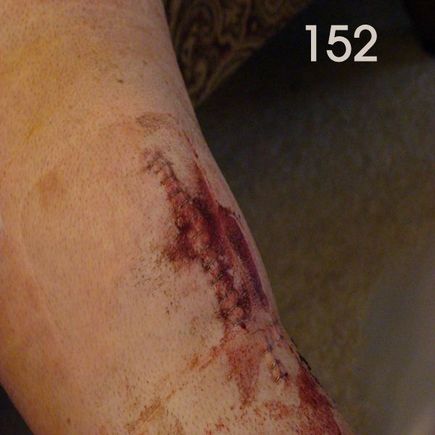 my leg152.jpg