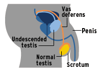 illo_testicular012599.gif