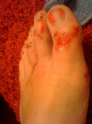 dont ask, shoe flew off, even scraped my polish off =(